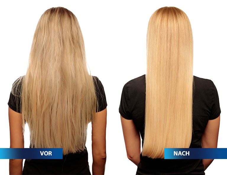 HAARKRYOTHERAPIE HAIR.TOXX Ritual